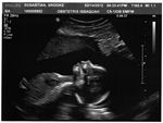 Ultrasound Image #1