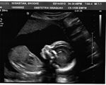 Ultrasound Image #2