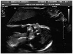 Ultrasound Image #3